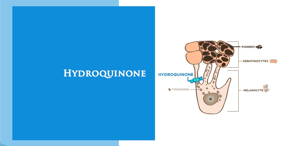 hydroquinone là gì